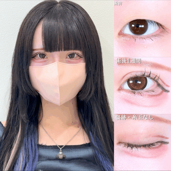No.17057の症例写真