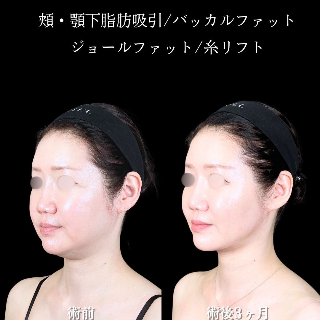 No.17108の症例写真2