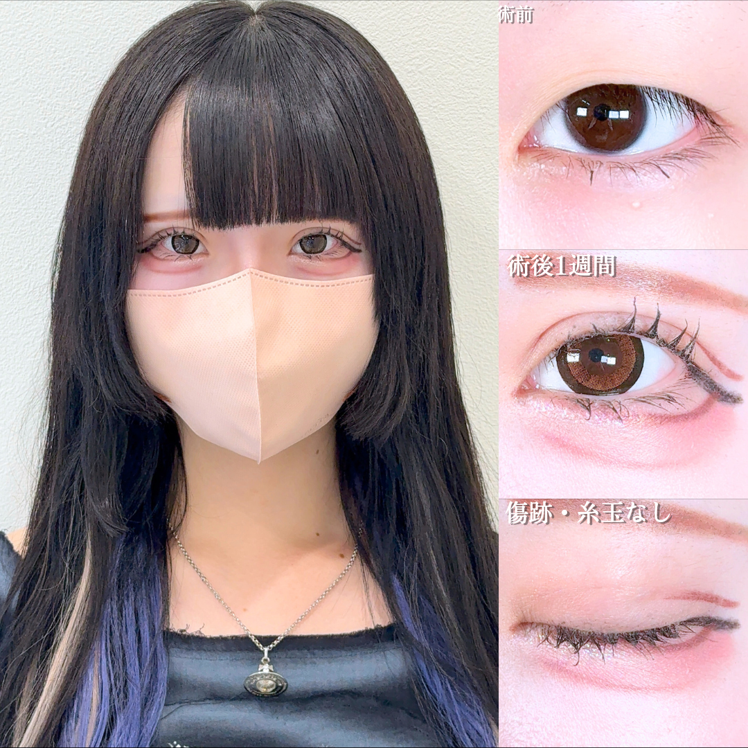 No.17057の症例写真 No.17057の症例写真