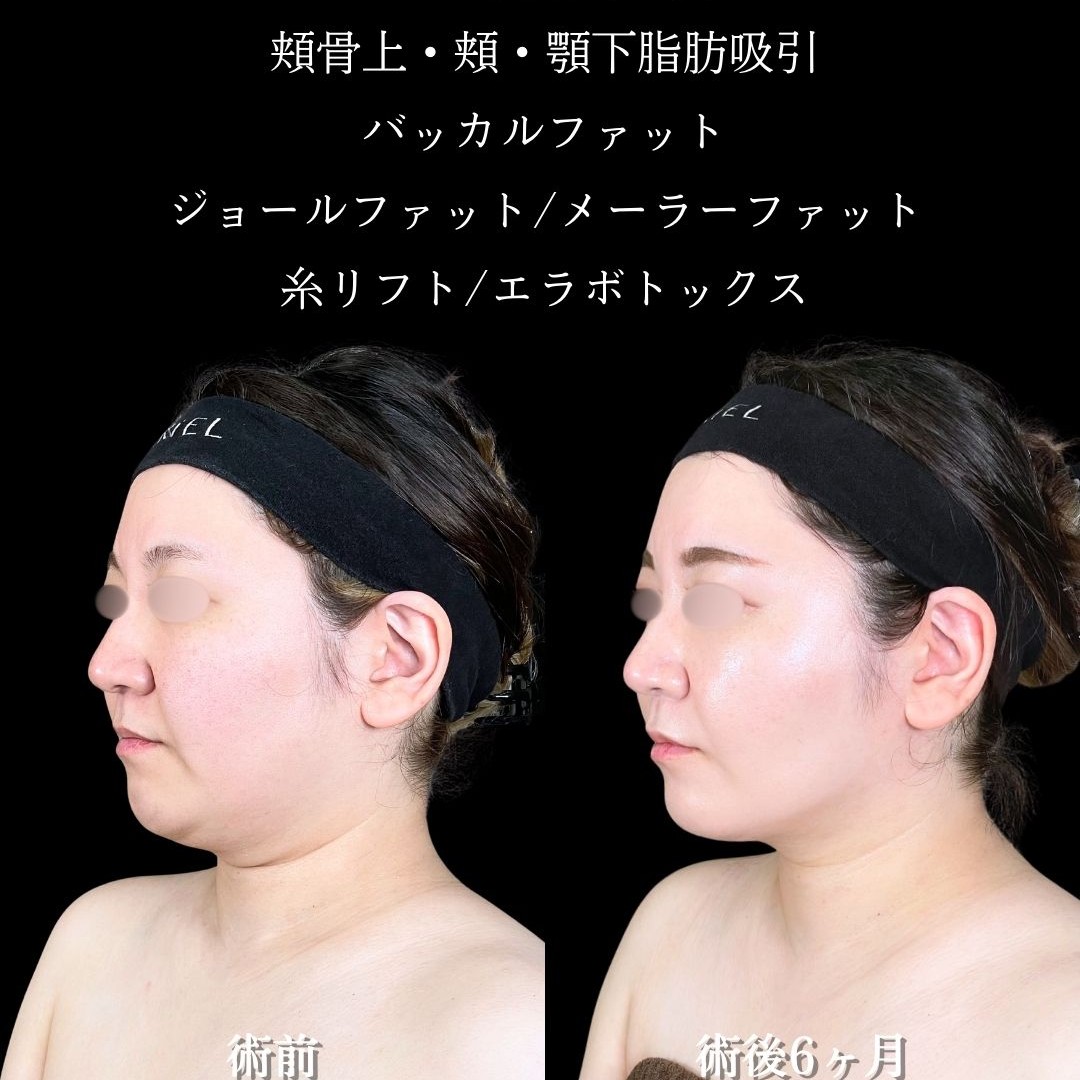 No.17301の症例写真3