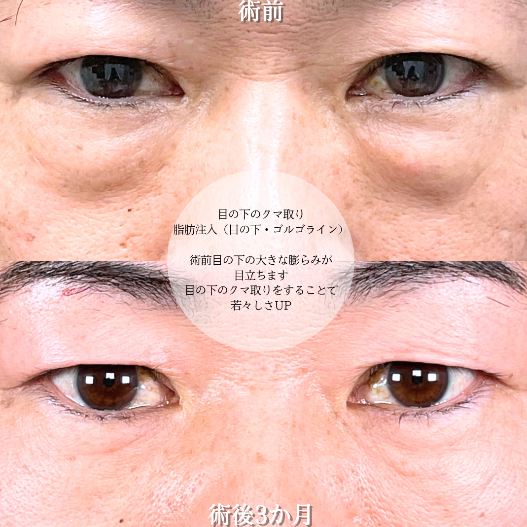 No.17071の症例写真2