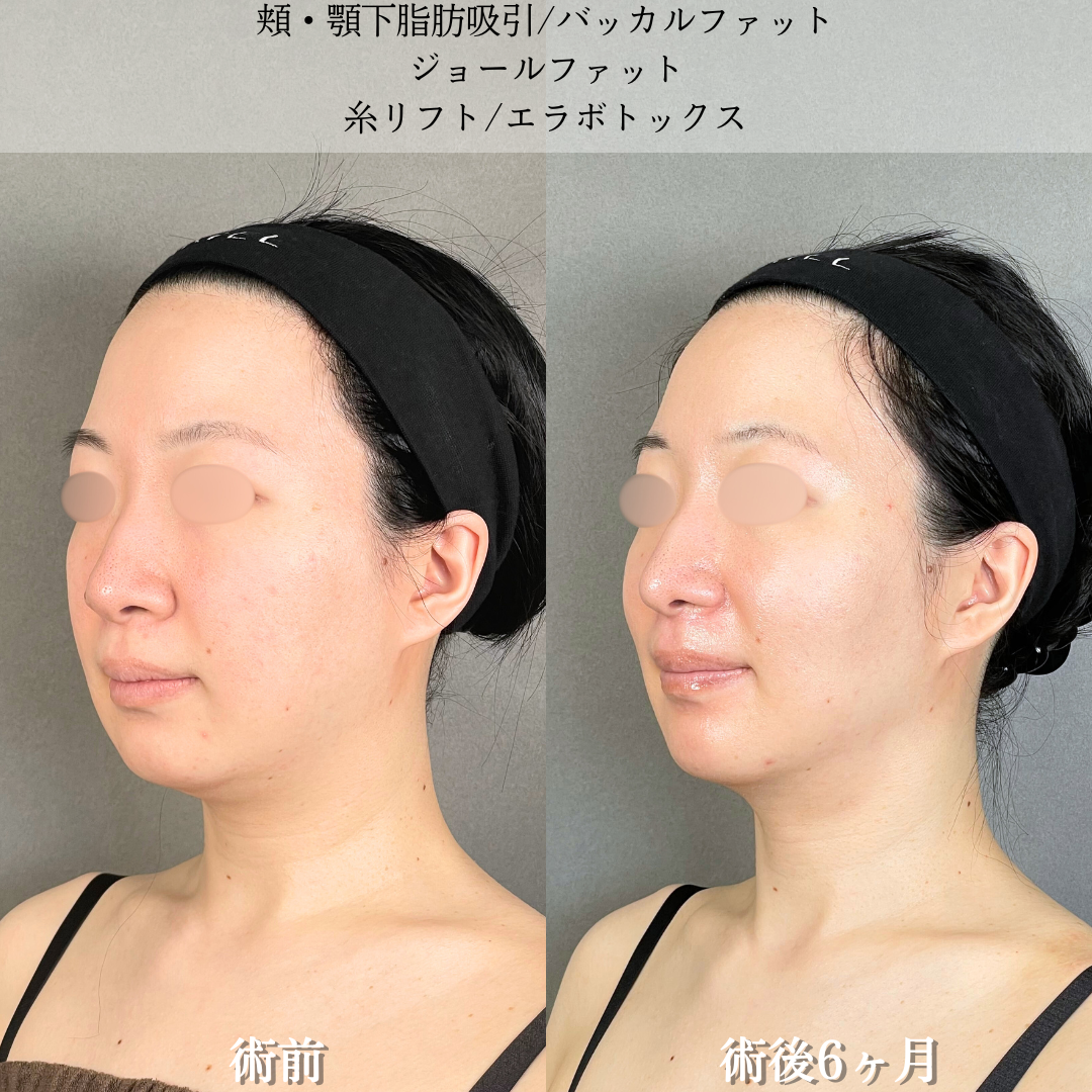No.17554の症例写真2