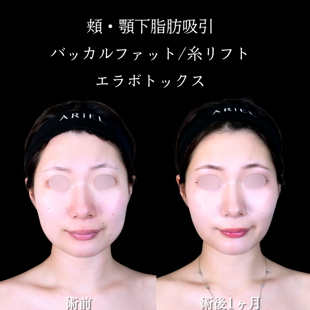 No.17047の症例写真2
