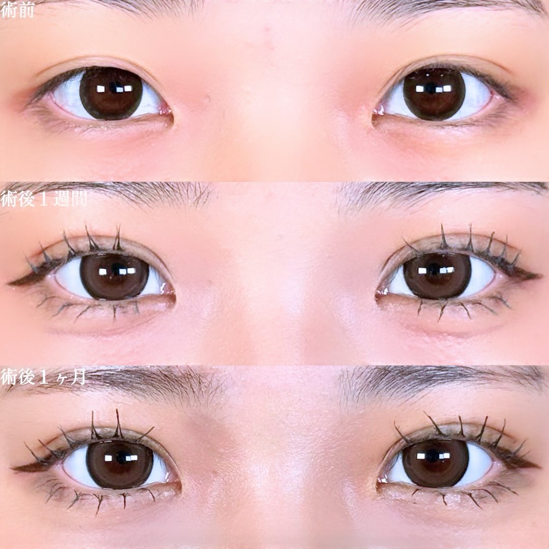 No.17507の症例写真 No.17507の症例写真