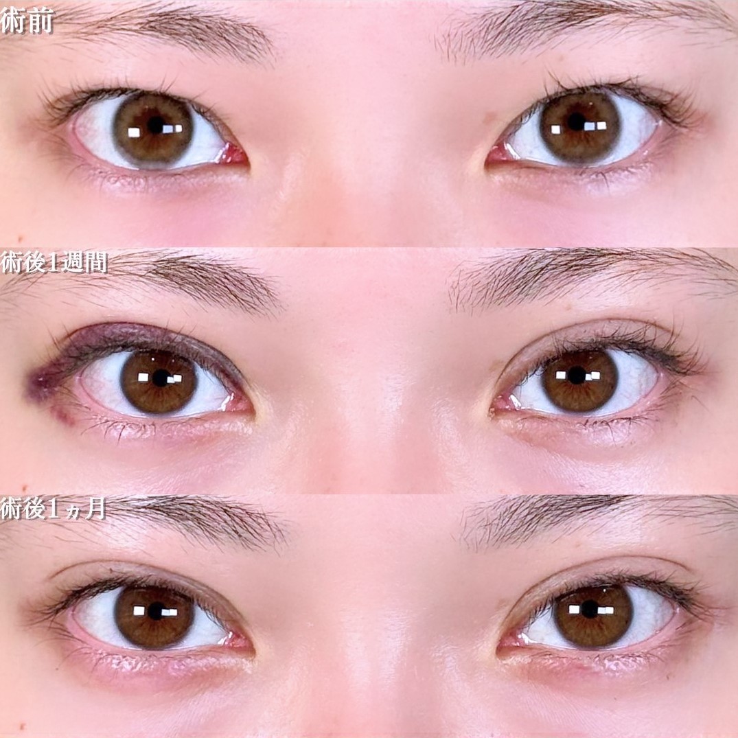 No.17193の症例写真 No.17193の症例写真