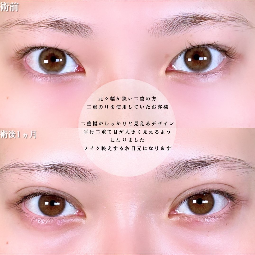 No.17193の症例写真1