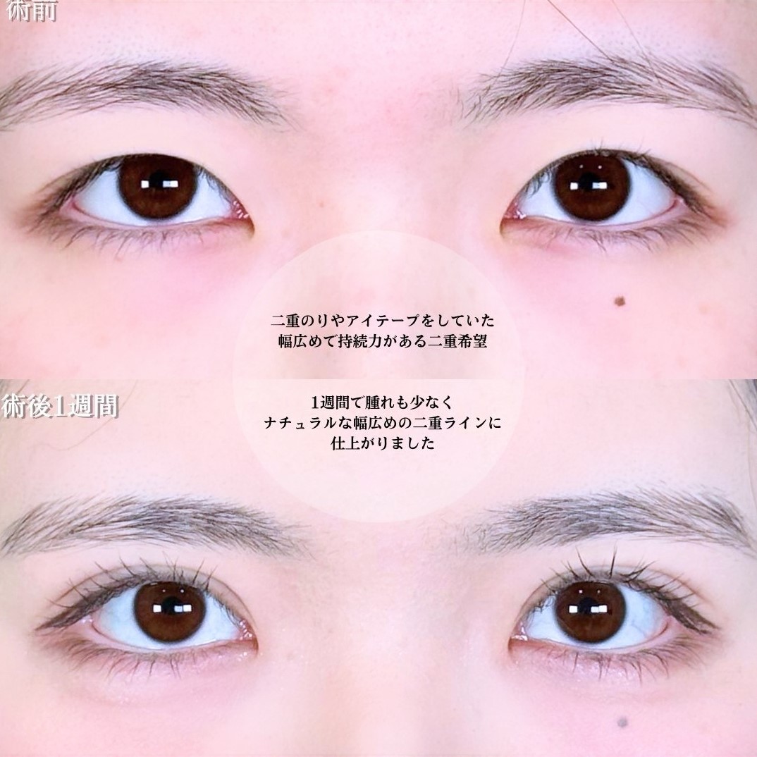 No.17306の症例写真1