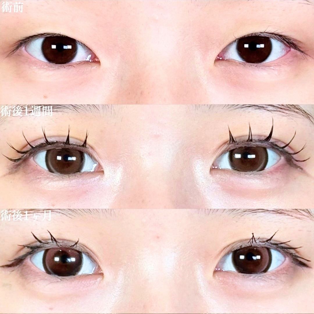 No.17547の症例写真 No.17547の症例写真