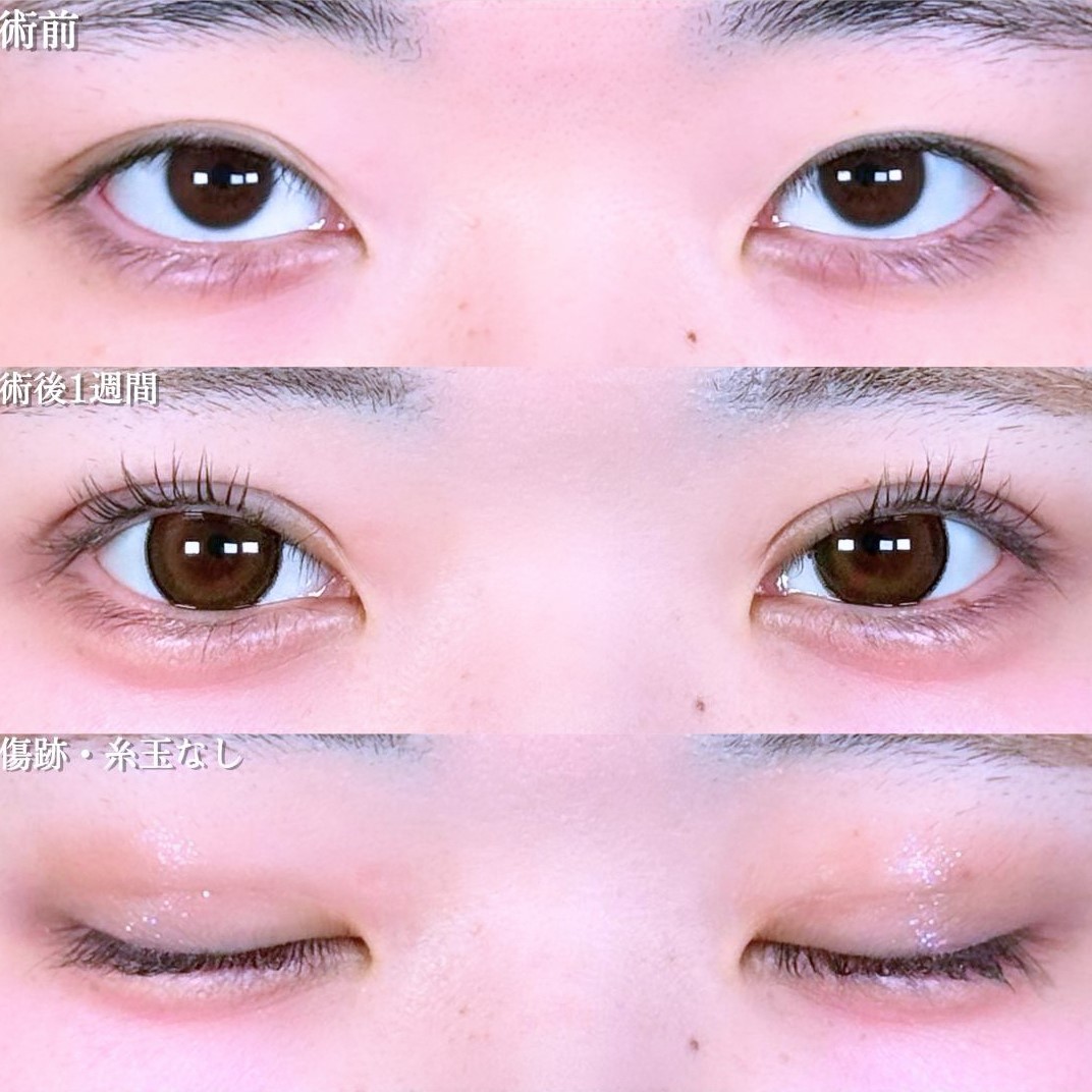 No.17513の症例写真 No.17513の症例写真