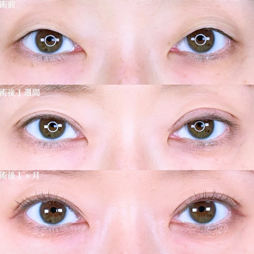 No.17405の症例写真 No.17405の症例写真
