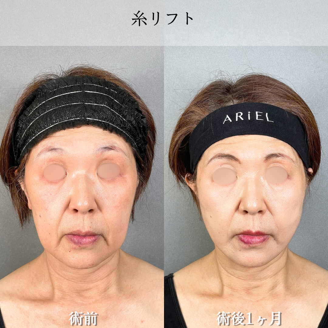 No.17211の症例写真2