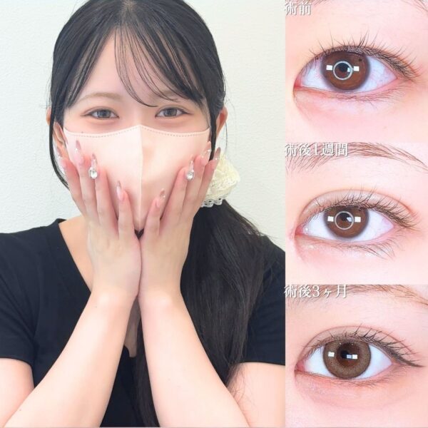 No.17227の症例写真
