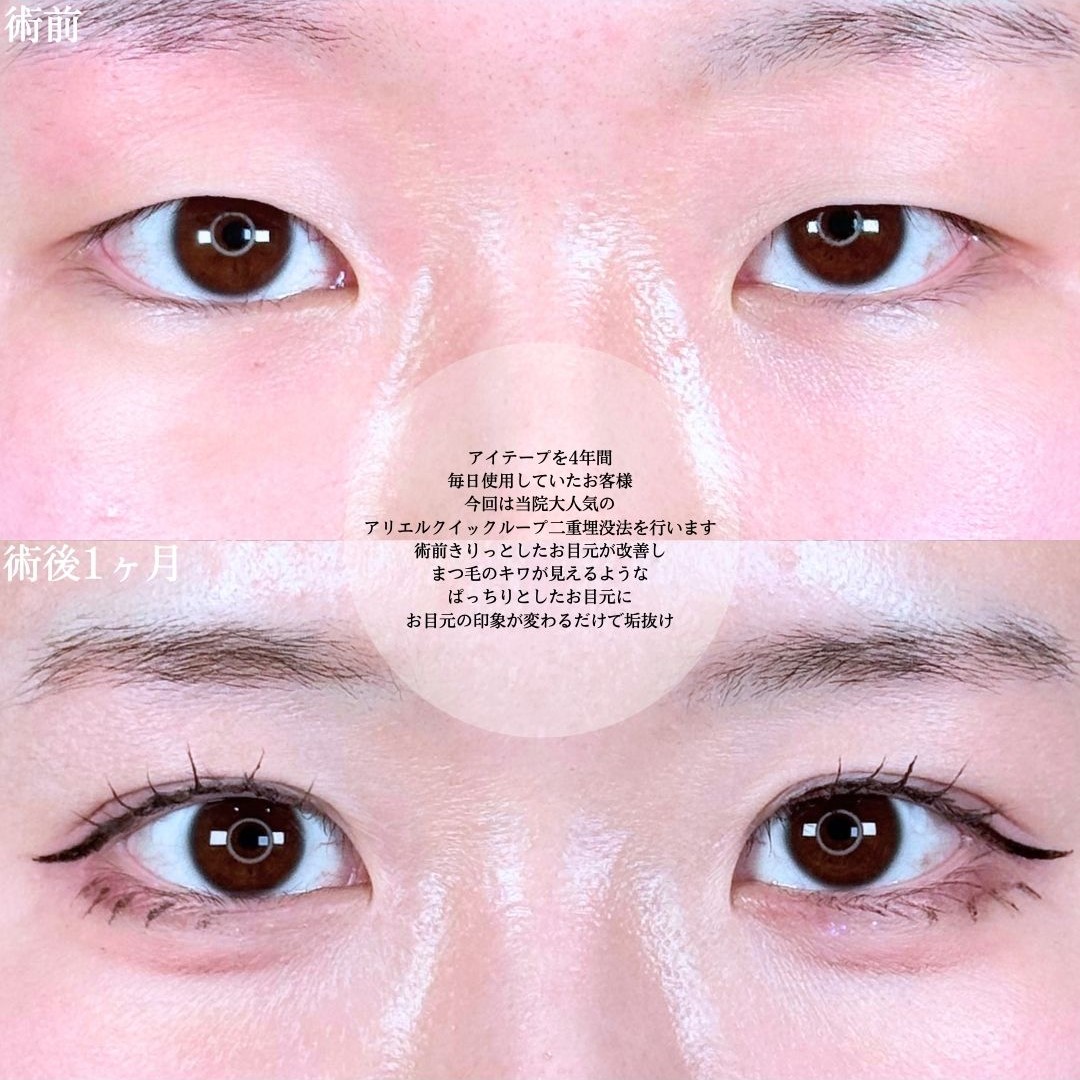 No.17359の症例写真1