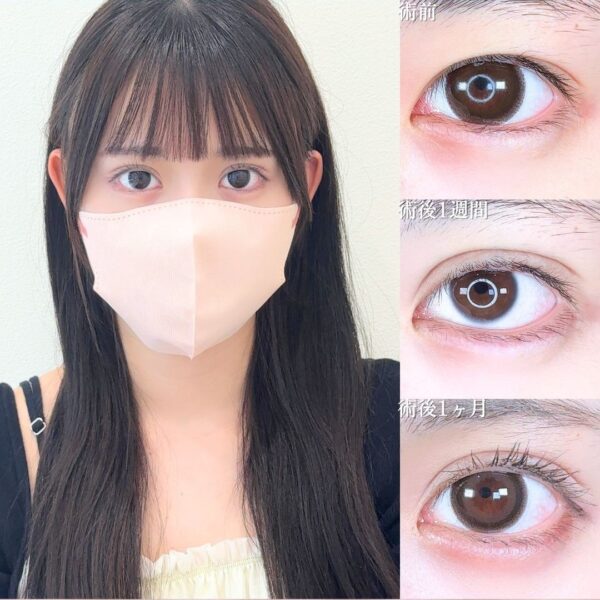 No.17291の症例写真
