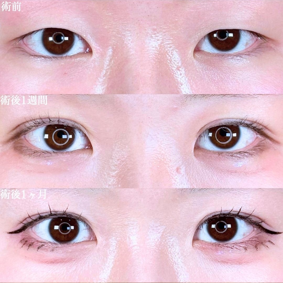 No.17359の症例写真