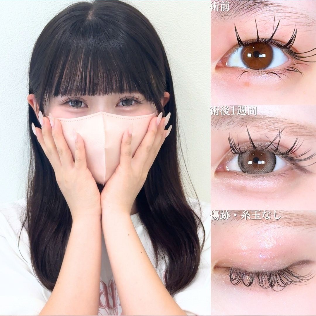 No.17532の症例写真 No.17532の症例写真