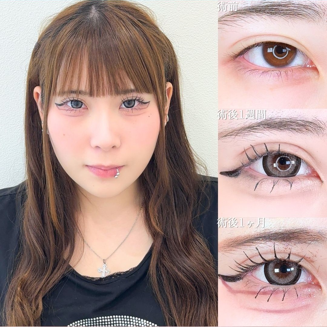 No.17186の症例写真 No.17186の症例写真
