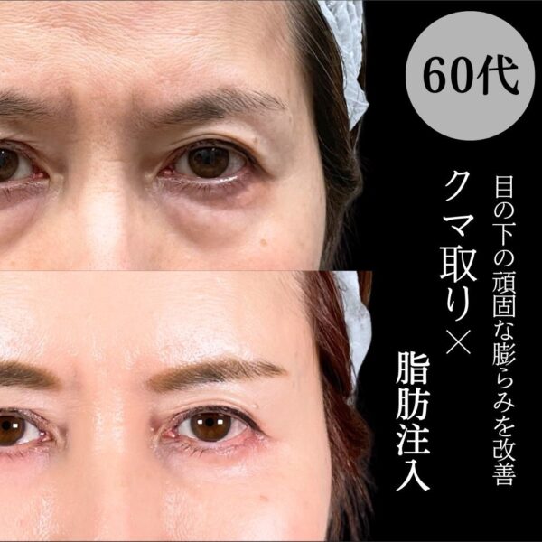 No.17519の症例写真