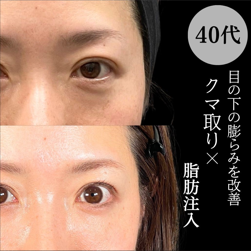 No.17178の症例写真