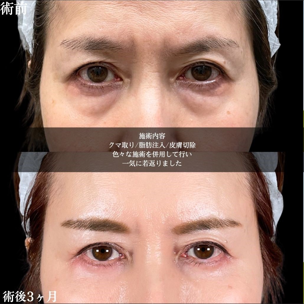No.17519の症例写真1