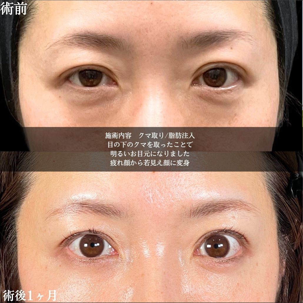 No.17178の症例写真1