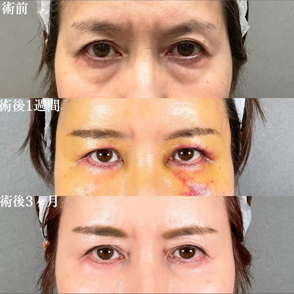 No.17519の症例写真2