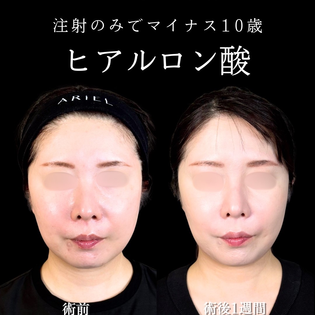 No.17155の症例写真 No.17155の症例写真