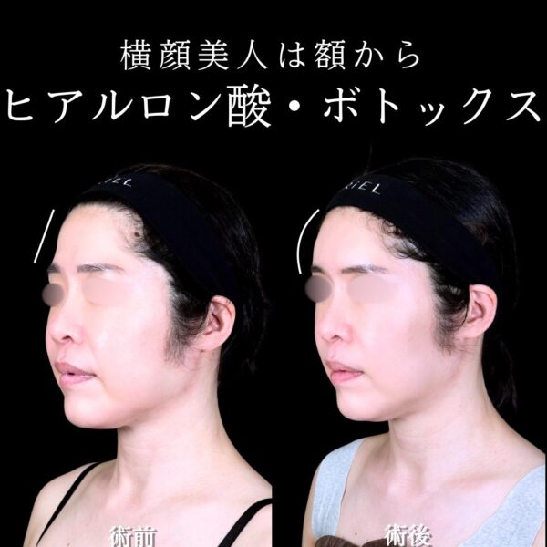 No.17239の症例写真