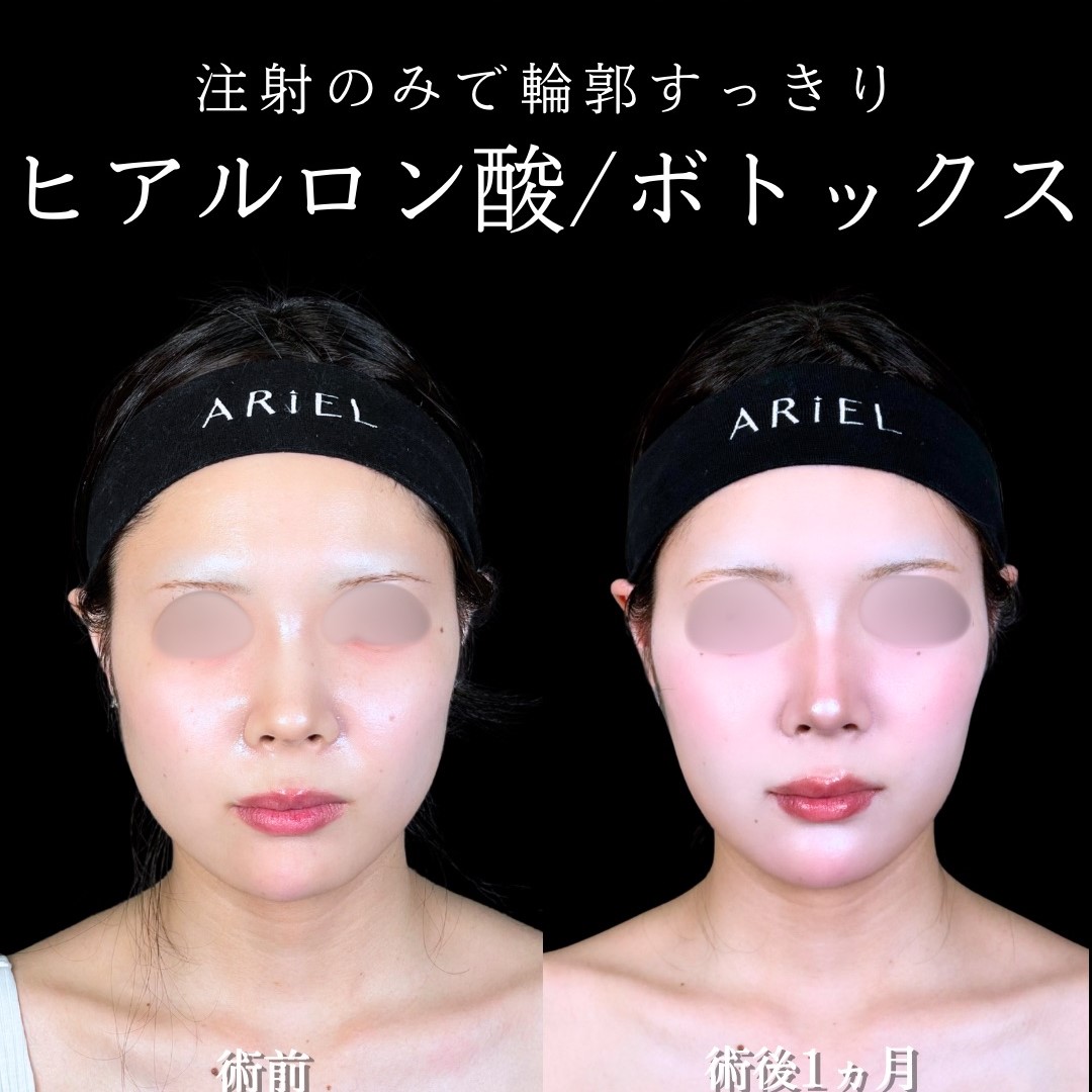 No.17091の症例写真 No.17091の症例写真