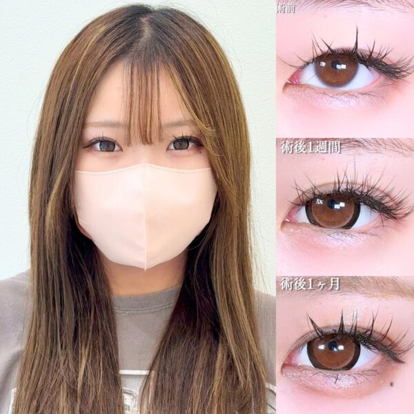 No.17411の症例写真
