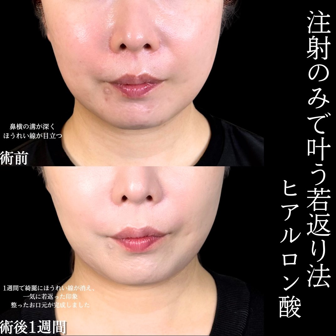 No.17155の症例写真1