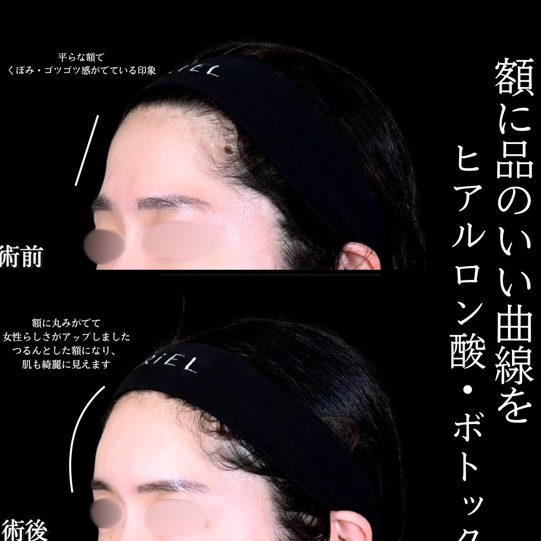 No.17239の症例写真1