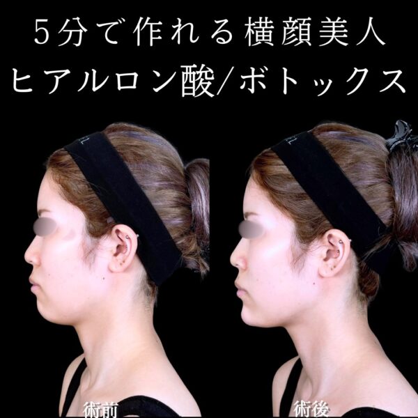 No.17284の症例写真