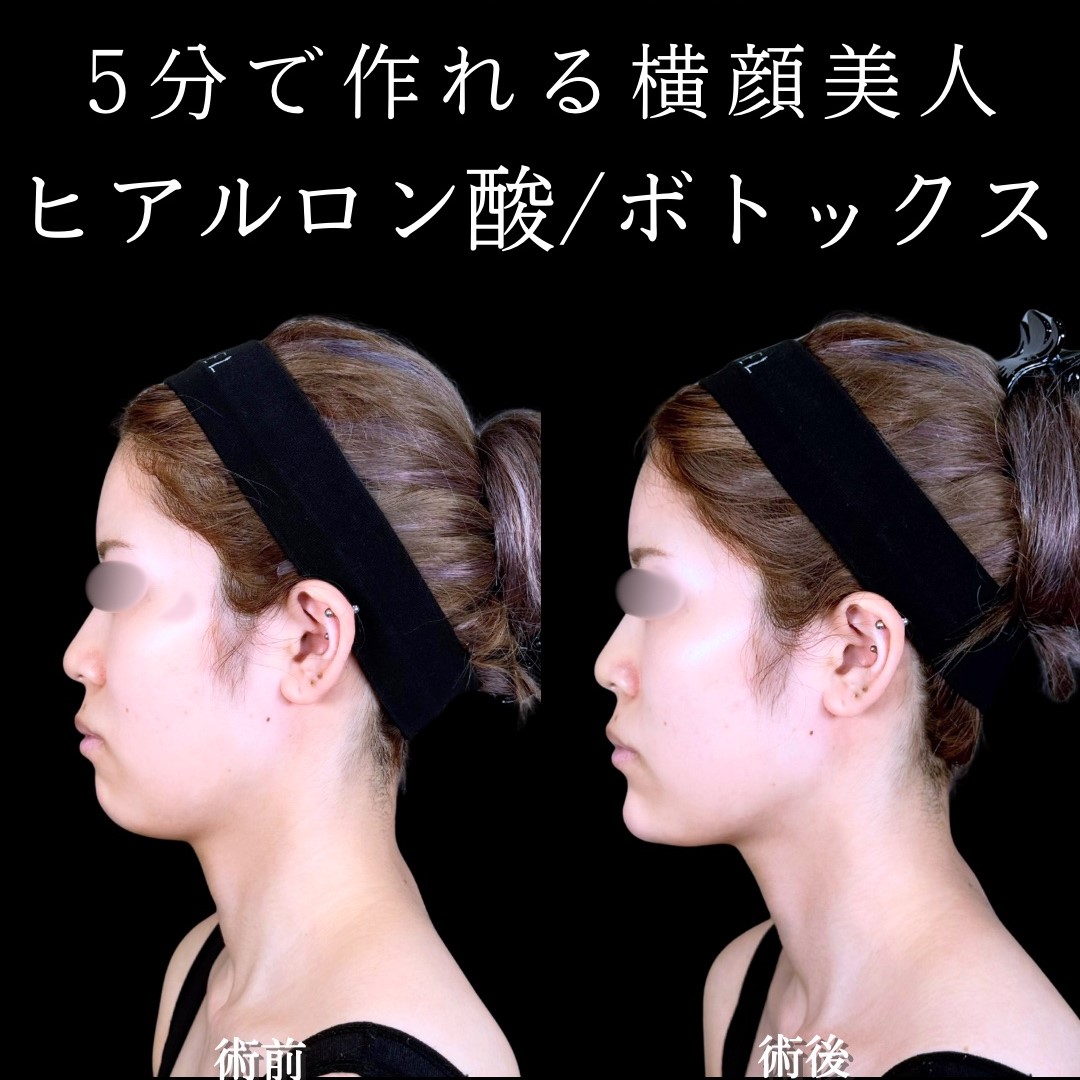 No.17284の症例写真