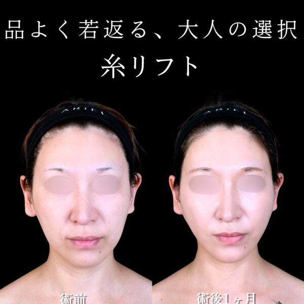 No.17330の症例写真