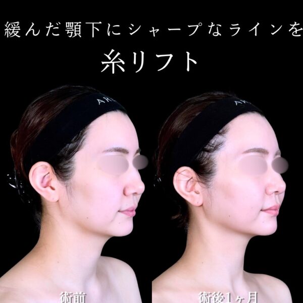 No.17380の症例写真