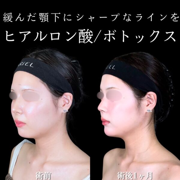 No.17566の症例写真