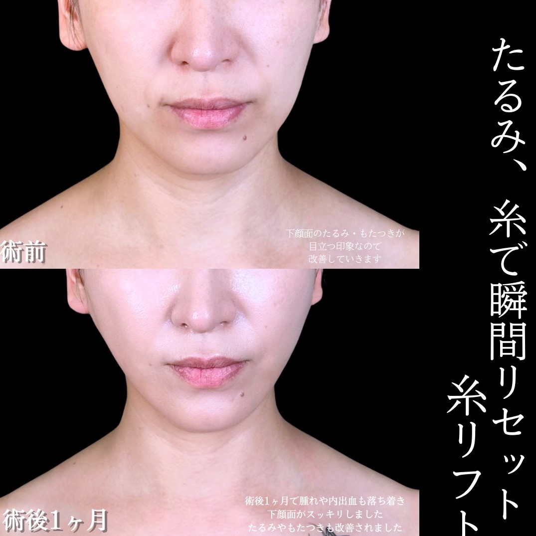 No.17330の症例写真1