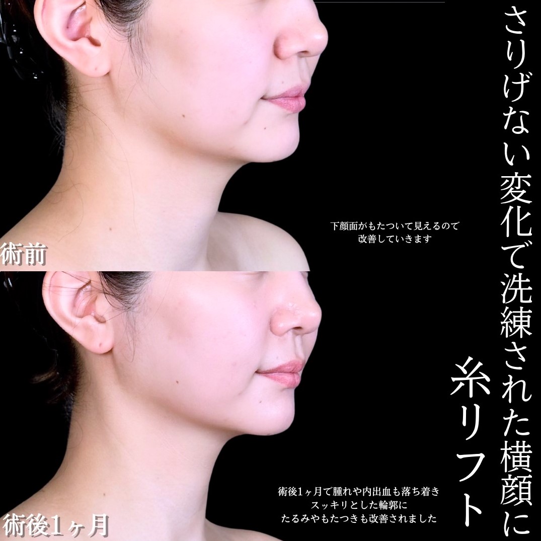 No.17380の症例写真1