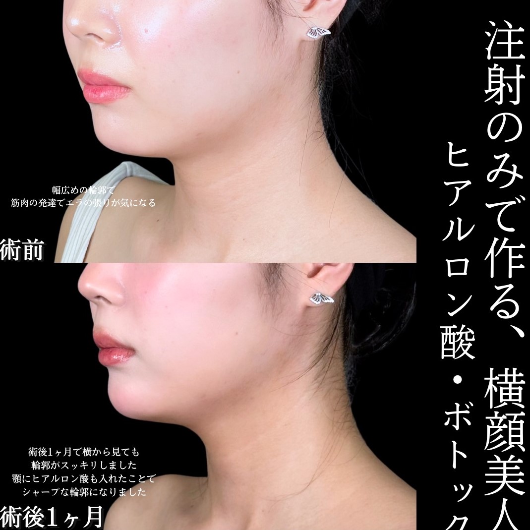 No.17566の症例写真1
