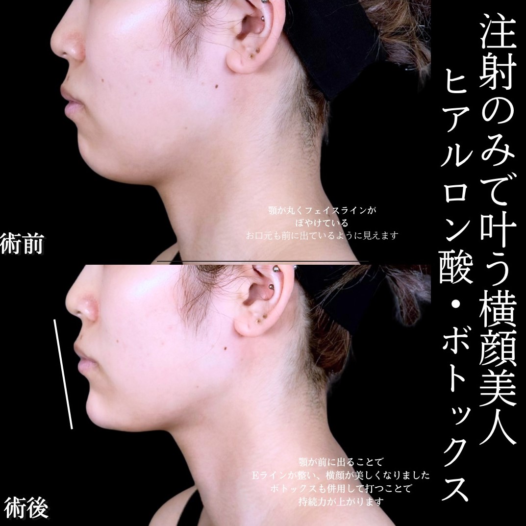 No.17284の症例写真1