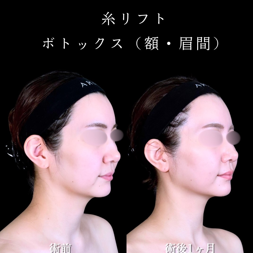 No.17380の症例写真2
