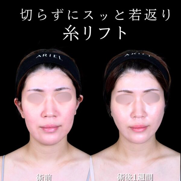 No.17490の症例写真