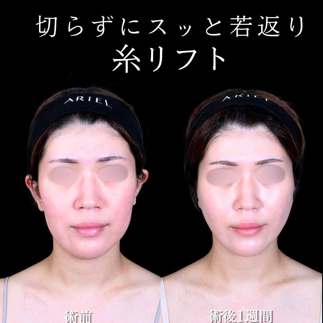 No.17490の症例写真 No.17490の症例写真
