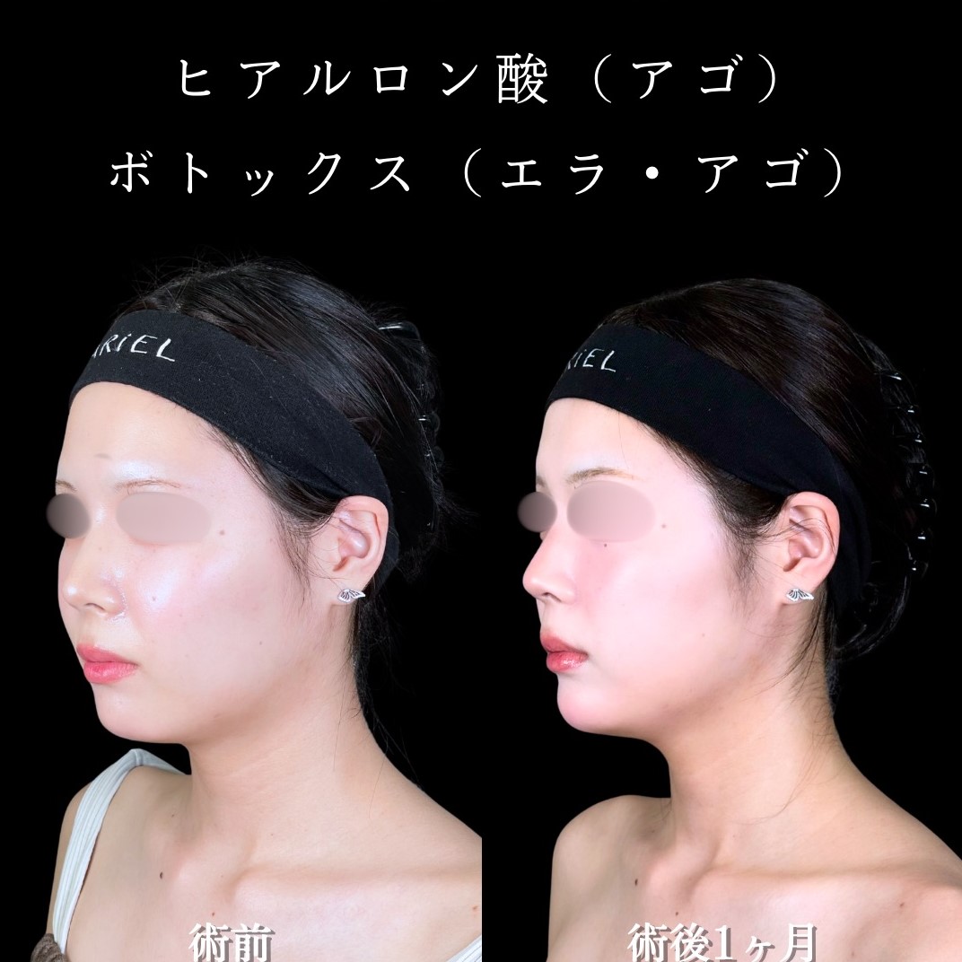 No.17566の症例写真2