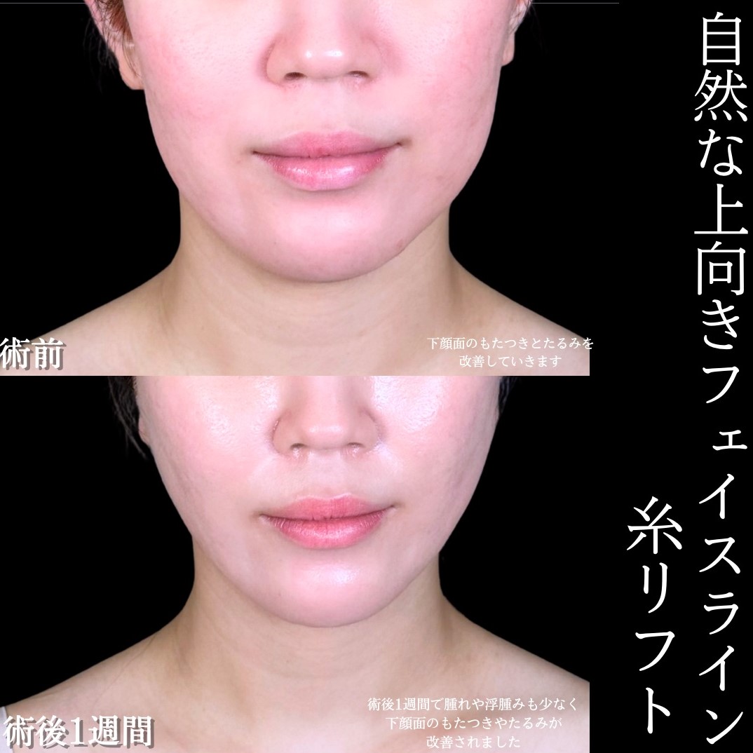 No.17490の症例写真1