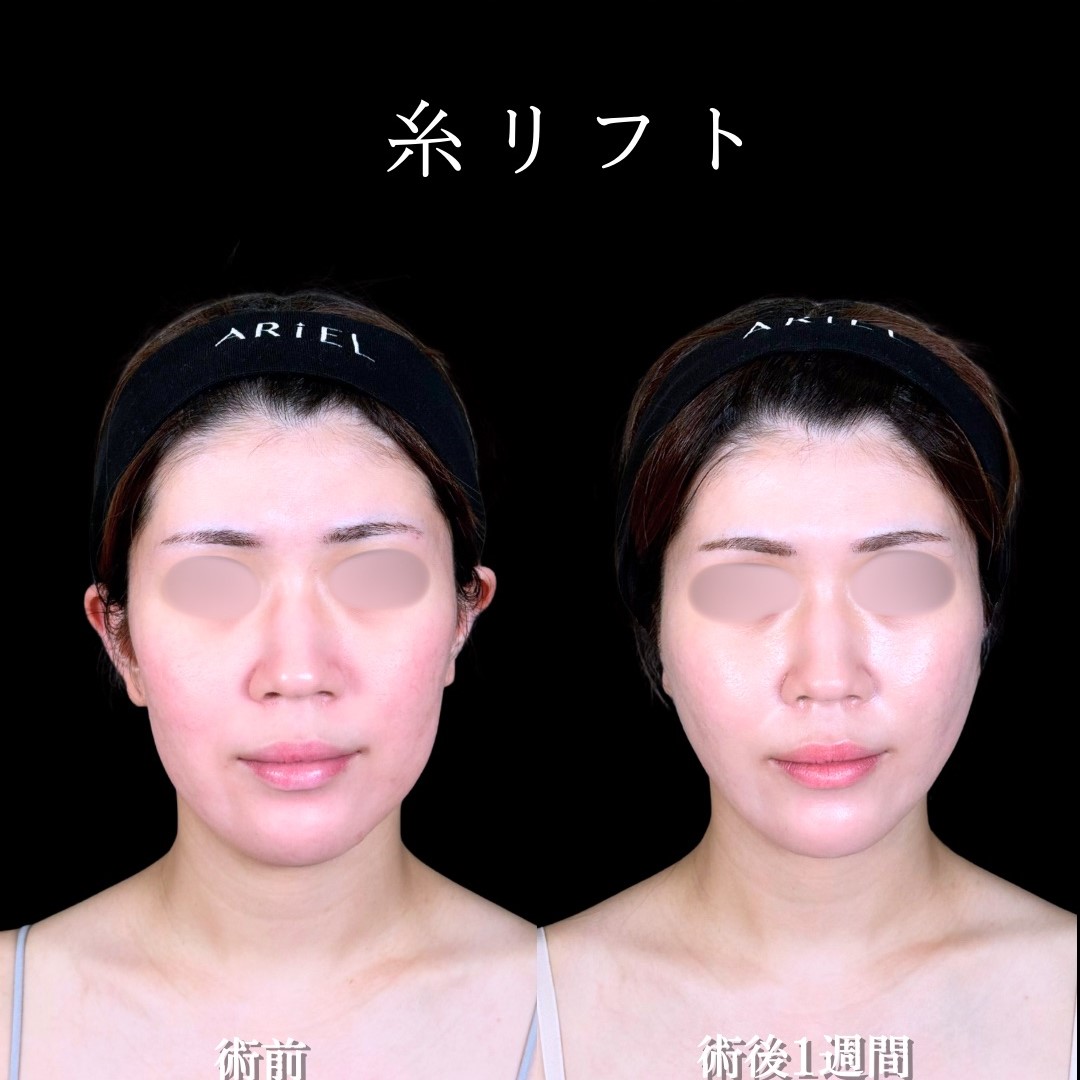 No.17490の症例写真2