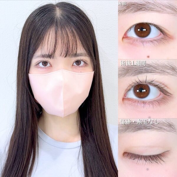 No.17318の症例写真