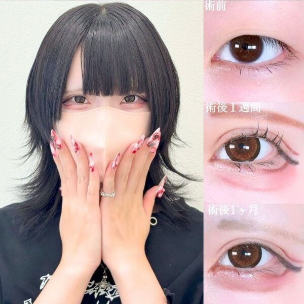 No.17526の症例写真