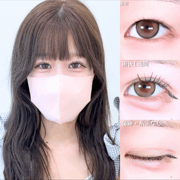 No.17147の症例写真